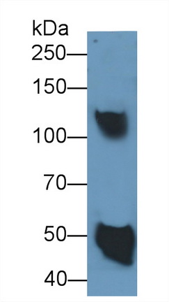 Monoclonal Antibody to Ceruloplasmin (CP)