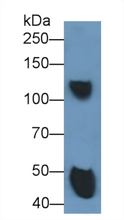 Monoclonal Antibody to Ceruloplasmin (CP)