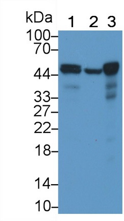 Monoclonal Antibody to Tumor Protein p53 (P53)