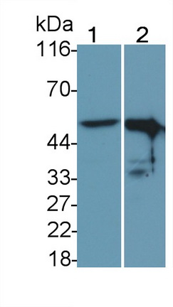 Monoclonal Antibody to Tumor Protein p53 (P53)