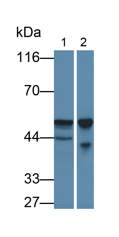 Monoclonal Antibody to Tumor Protein p53 (P53)