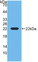 Monoclonal Antibody to Retinol Binding Protein 4 (RBP4)