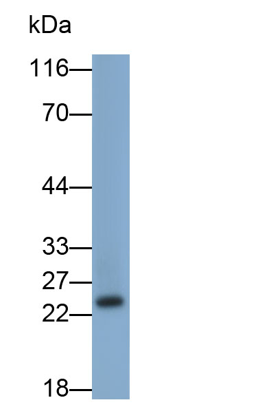 Monoclonal Antibody to Retinol Binding Protein 4 (RBP4)