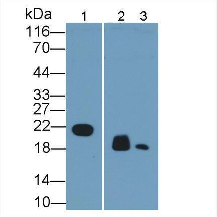 Monoclonal Antibody to Retinol Binding Protein 4 (RBP4)