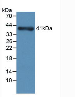 Monoclonal Antibody to Nephrin (NPHN)