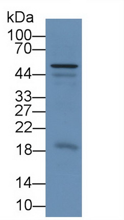 Monoclonal Antibody to Chemerin (CHEM)