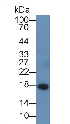 Monoclonal Antibody to Chemerin (CHEM)