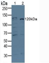 Monoclonal Antibody to Amyloid Beta Peptide 1-42 (Ab1-42)