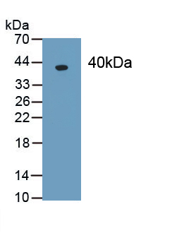 Monoclonal Antibody to Procollagen I N-Terminal Propeptide (PINP)