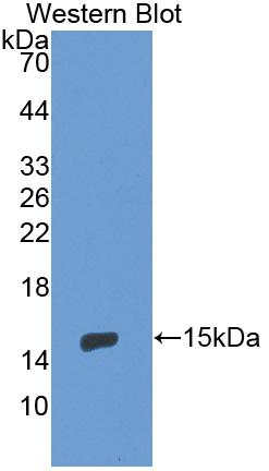 Monoclonal Antibody to Endoglin (ENG)