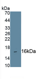 Monoclonal Antibody to Cluster Of Differentiation 160 (CD160)