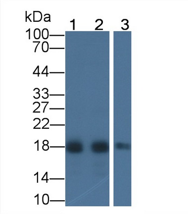 Monoclonal Antibody to Acid Phosphatase 1 (ACP1)