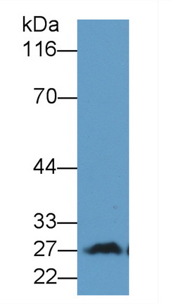 Monoclonal Antibody to Protein Zero, Myelin (MPZ)