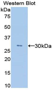 Monoclonal Antibody to Angiopoietin Like Protein 4 (ANGPTL4)