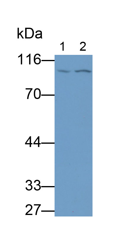 Monoclonal Antibody to Beta Catenin (β-catenin)