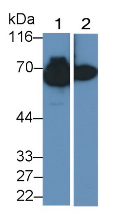 Monoclonal Antibody to Albumin (ALB)