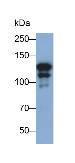 Monoclonal Antibody to Integrin Alpha 2B (ITGa2B)