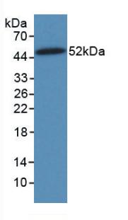 Monoclonal Antibody to Vimentin (VIM)