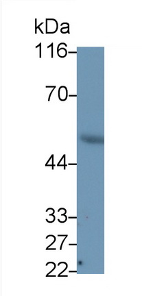 Monoclonal Antibody to Vimentin (VIM)