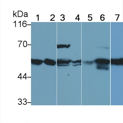 Monoclonal Antibody to Vimentin (VIM)