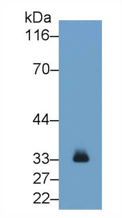 Monoclonal Antibody to Tryptase (TPS)