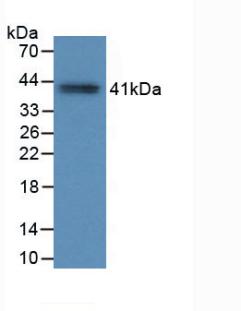 Monoclonal Antibody to Tryptase (TPS)