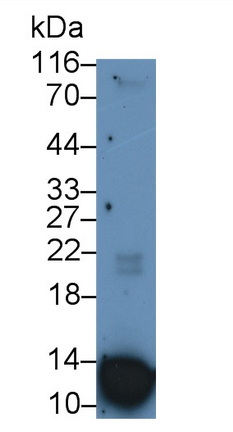Monoclonal Antibody to S100 Calcium Binding Protein A12 (S100A12)