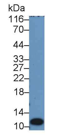 Monoclonal Antibody to S100 Calcium Binding Protein A12 (S100A12)