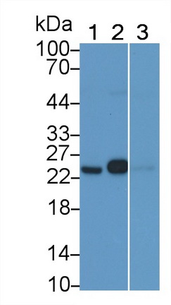 Monoclonal Antibody to Glutathione S Transferase Pi (GSTp)