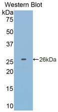 Monoclonal Antibody to Glutathione S Transferase Pi (GSTp)