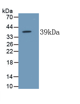 Monoclonal Antibody to Alkaline Phosphatase, Tissue-nonspecific (ALPL)