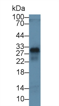 MAB099Hu23.jpg