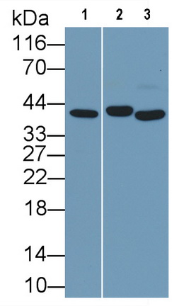 Monoclonal Antibody to Arginase (ARG)