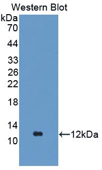 Monoclonal Antibody to Fibrinogen Alpha Chain (FGA)