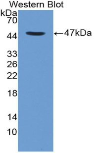 Monoclonal Antibody to Cluster Of Differentiation 4 (CD4)