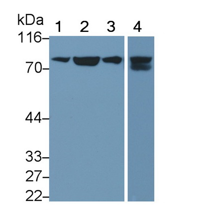 Monoclonal Antibody to Transferrin Receptor (TFR)