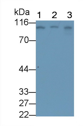 Monoclonal Antibody to Transferrin Receptor (TFR)