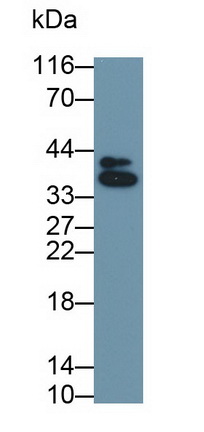 MAB175Hu22.jpg