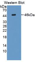 Monoclonal Antibody to Interleukin 31 (IL31)