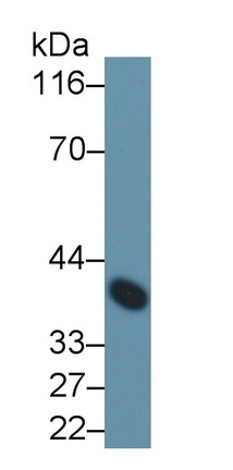 Monoclonal Antibody to Clusterin (CLU)