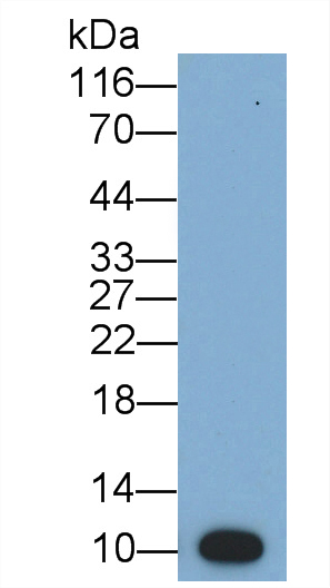 Monoclonal Antibody to Glucose Transporter 1 (GLUT1)