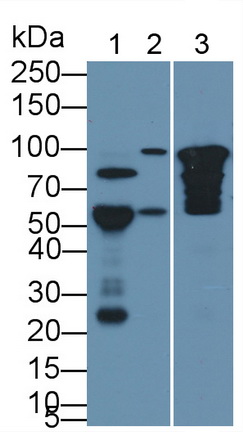 Monoclonal Antibody to Cartilage Oligomeric Matrix Protein (COMP)