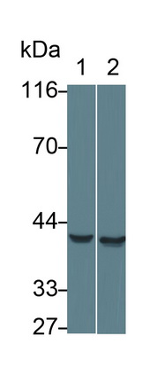 Monoclonal Antibody to Aspartate Aminotransferase (AST)