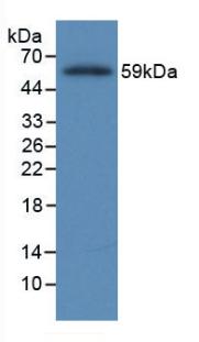 Monoclonal Antibody to Fibrinogen Beta Chain (FGB)