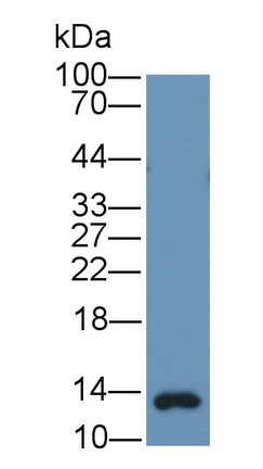 Monoclonal Antibody to Gastrin (GT)