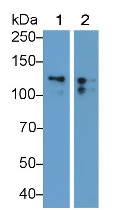 Monoclonal Antibody to Cluster Of Differentiation 56 (CD56)