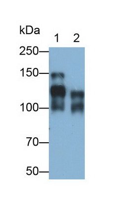 Monoclonal Antibody to Cluster Of Differentiation 56 (CD56)