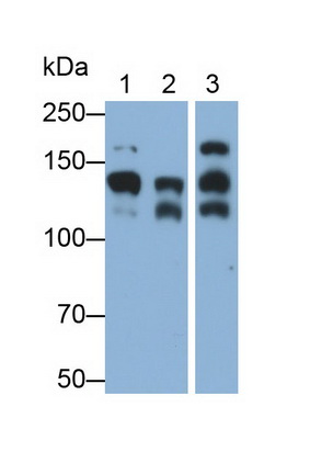 Monoclonal Antibody to Cluster Of Differentiation 56 (CD56)