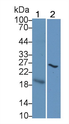 Monoclonal Antibody to Cytotoxic T-Lymphocyte Associated Antigen 4 (CTLA4)