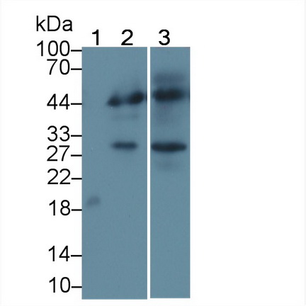 Monoclonal Antibody to Cytotoxic T-Lymphocyte Associated Antigen 4 (CTLA4)